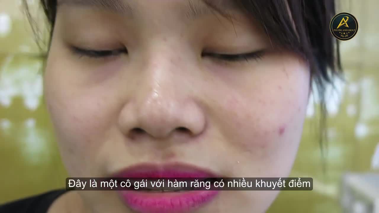 Một quá trình dài