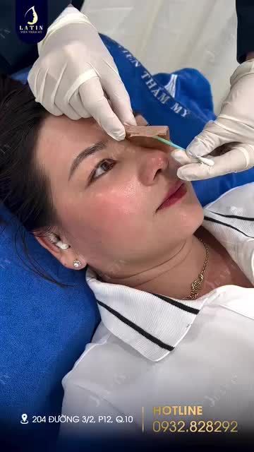 "Tự nhiên làm mũi xong chị thấy mắt cũng đẹp hơn "
