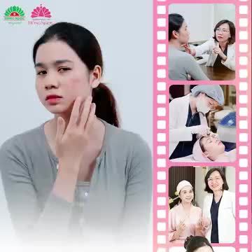 DA SẠCH MỤN CĂNG MƯỚT TỰ TIN ĐÓN TẾT