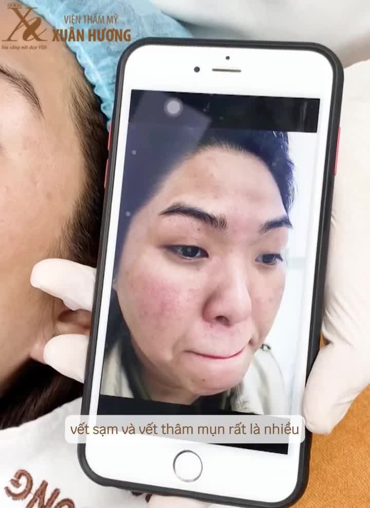 Tút da cấp tốc, Tết đẹp rạng ngời