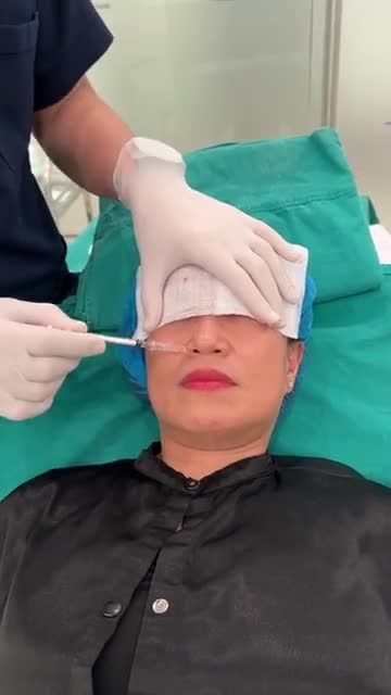 RÃNH MŨI MÁ SÂU - CHỈ CẦN TIÊM LÀ HẾT.
