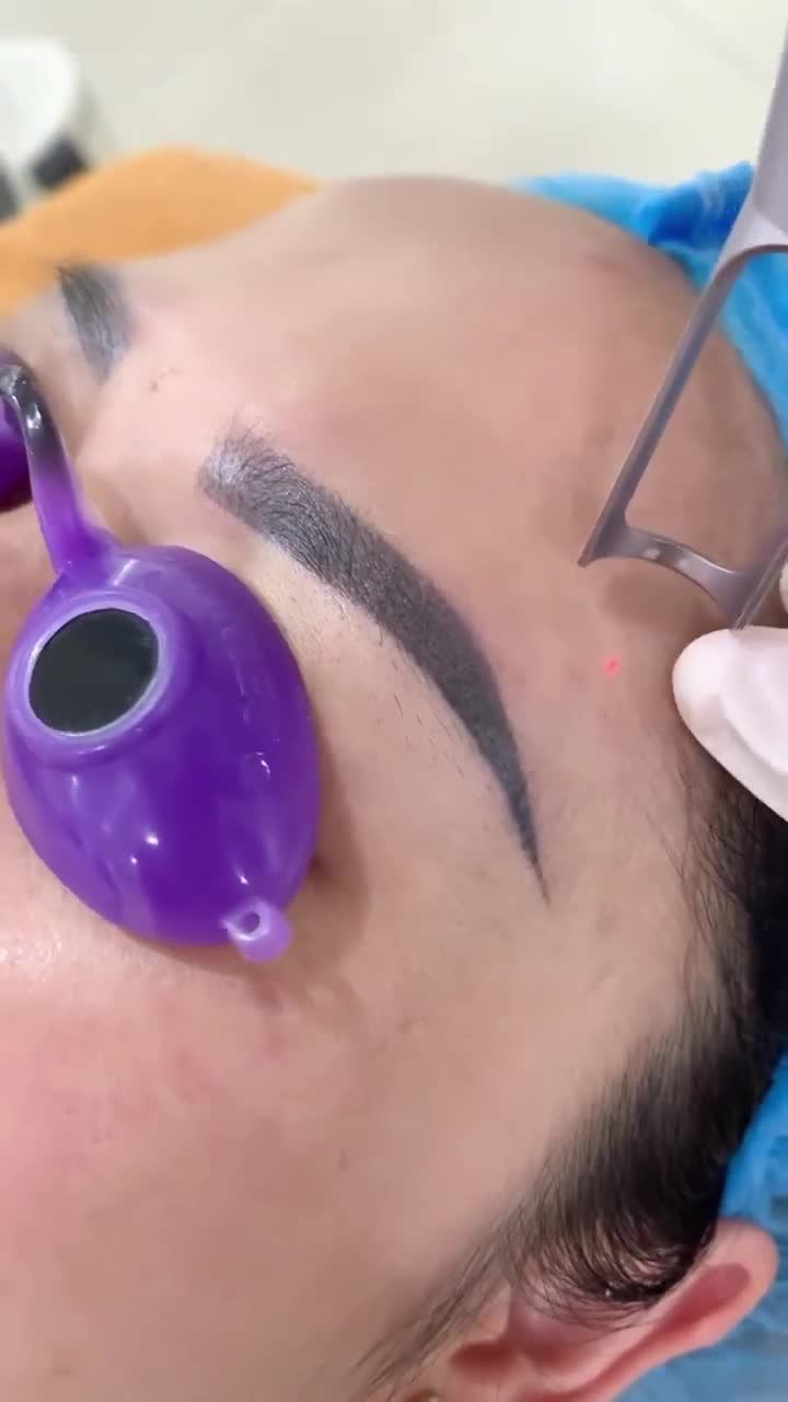 Hút mực xăm mày buổi 1