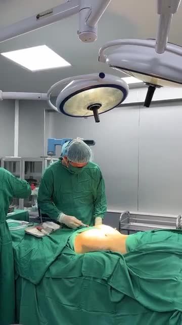 CẤY MỠ TỰ THÂN V3 CĂNG TRÒN, SEXY