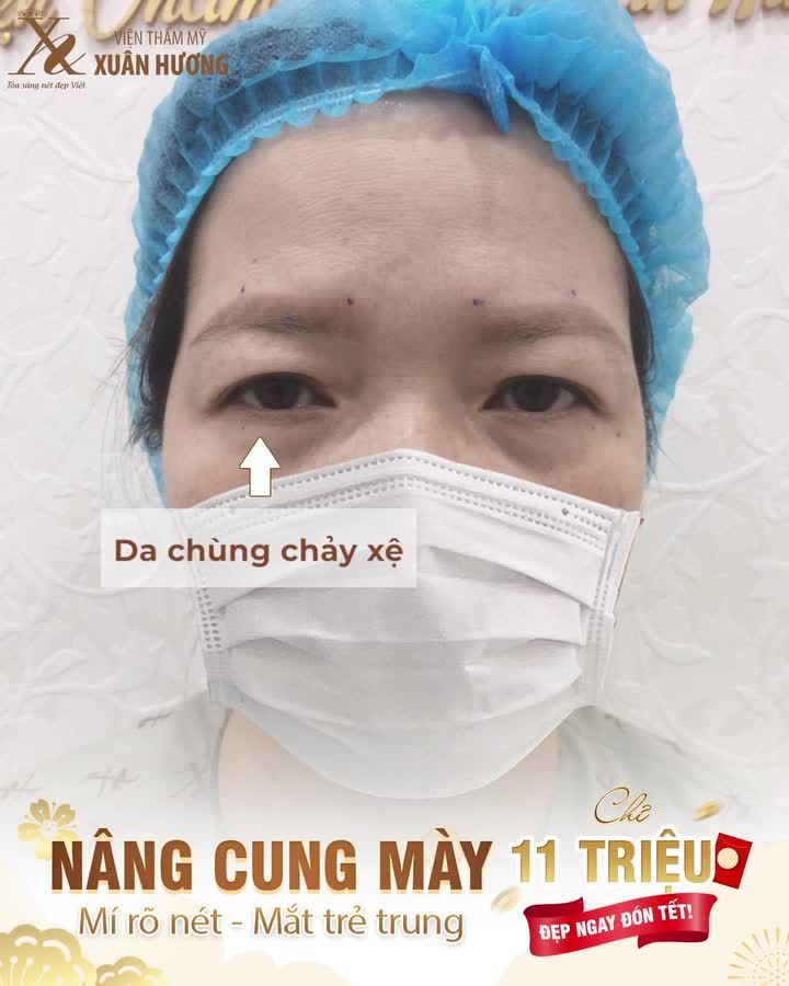 ĐẶT LỊCH NÂNG CUNG MÀY ĐÓN TẾT - NHẬN NGAY ƯU ĐÃI CUỐI CÙNG CỦA NĂM