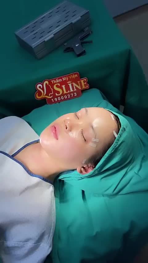 CẤY MỠ TỰ THÂN