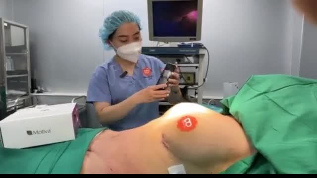 KẾT QUẢ 1 CA NÂNG V1 + TẠO HÌNH V2  RẤT ĐẸP!