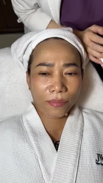 Quý cô DA MẶT KHÔ RÁP, NHĂN NHEO hạnh phúc với làn da như TRẺ LẠI 10 TUỔI chỉ sau 5 buổi Trẻ hóa da
