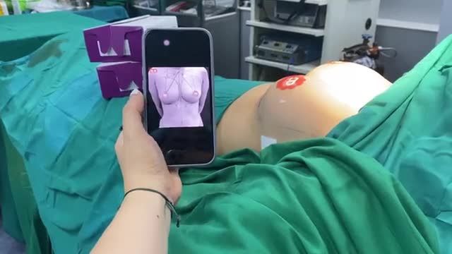 KẾT QUẢ CA NGỰC V1 TÚI NANOCHIP ERGONOMIX ĐỀU, ĐẸP