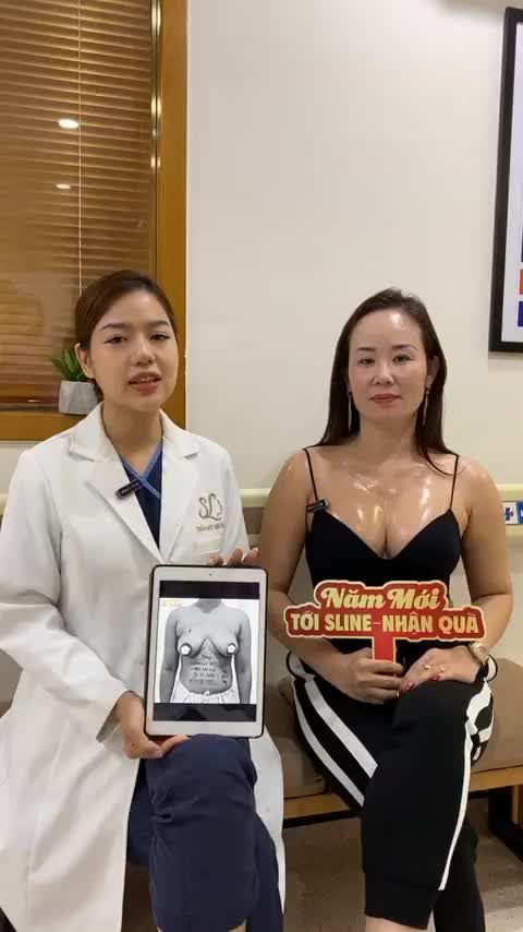 FEEDBACK NÂNG V1 TREO SA TRỄ SAU GẦN 2 THÁNG