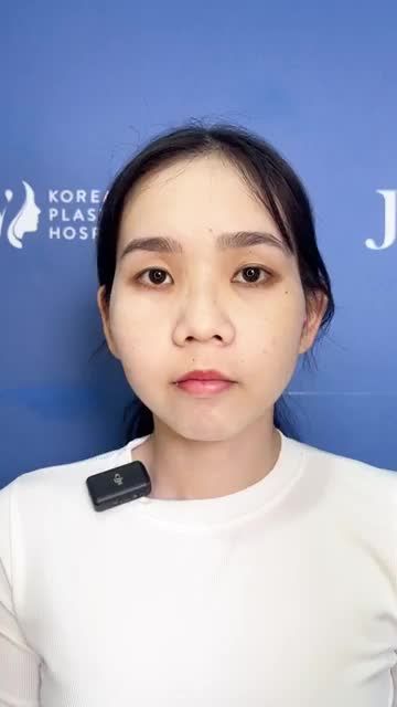Chiêm ngưỡng kết quả CẮT HÀM HÔ đẹp MÊ LY của HOTGIRL 9X