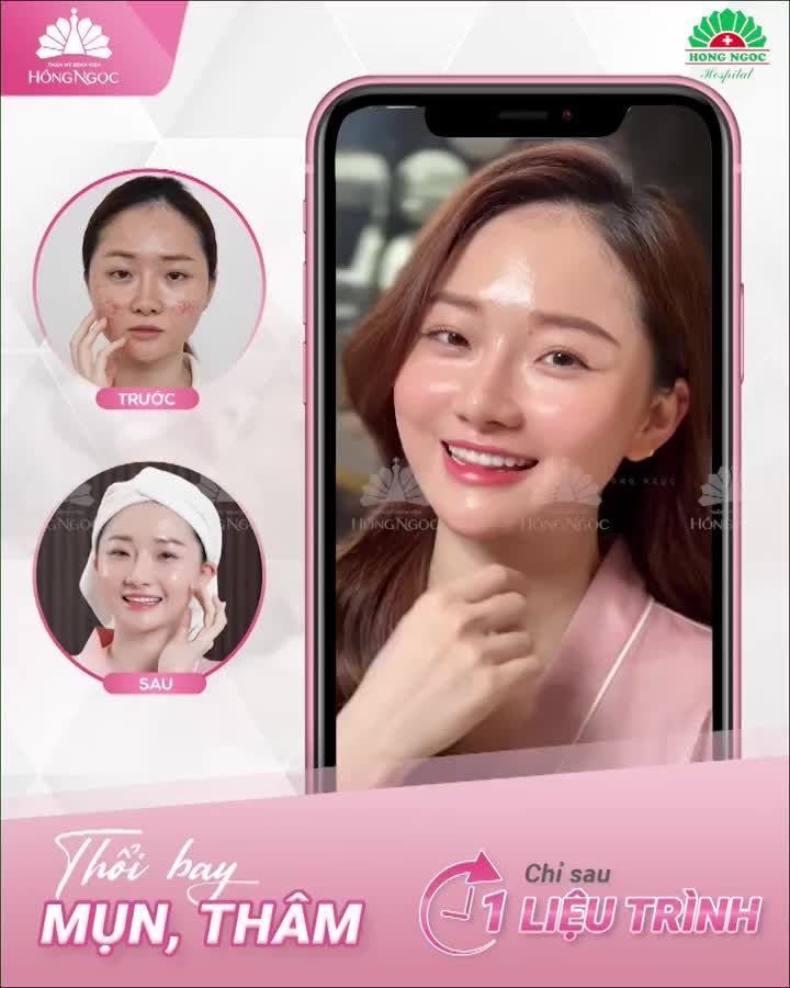 Chấm dứt ''duyên nợ'' với MỤN - Lan Anh đã lấy lại diện mạo tươi trẻ với trị mụn Chuẩn Y Khoa tại Hồng Ngọc.
