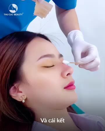 Muốn có dáng mũi đẹp và cái kết
