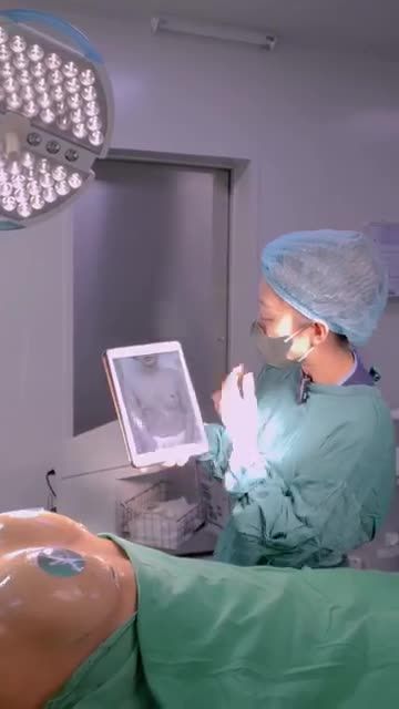 V1 đẹp xinh - tết rinh phú quý. Cùng theo dõi sự thay đổi của chị khách hàng trước và sau khi đến với Dr. Minh Phạm nhé!