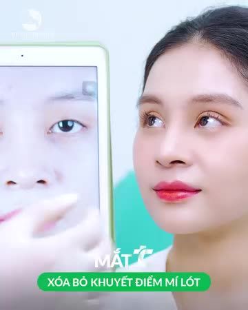 Thu Cúc xóa bỏ hết khuyết điểm mí mắt