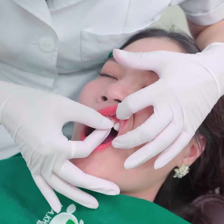 THẨM MỸ RĂNG KHÔNG MÀI NHỎ - CÔNG NGHỆ HIỆN ĐẠI NHẤT 2024