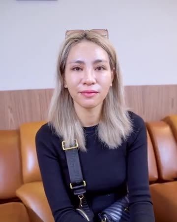 Mí sau 1 tháng thực hiện trông sẽ như thế nào? Theo dõi ngay