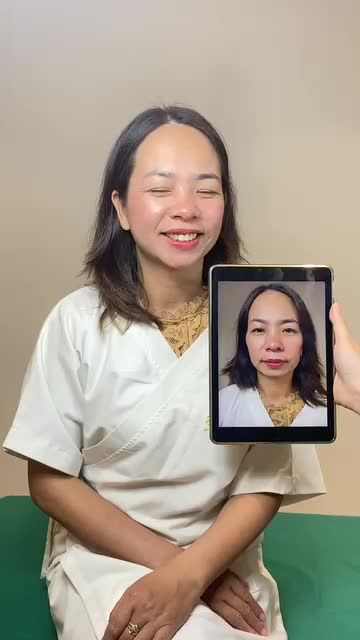 Mùng 1 sớm mai, mùng 2 đầu tháng với một ca "làm đầy Filler" siêuu ưng. Không quản đường xa, chị khách đi đi từ Bắc Ninh lên Hà Nội đến Tấm để làm đẹp.
