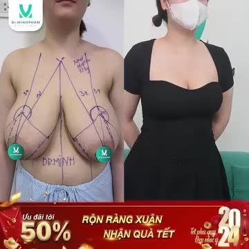 CÂU CHUYỆN GIẢI CỨU V1 CHO BẠN GÁI 20 TUỔI:
