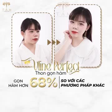 GƯƠNG MẶT NHỎ GỌN KHÔNG CẦN PHẪU THUẬT ĐAU ĐỚN
