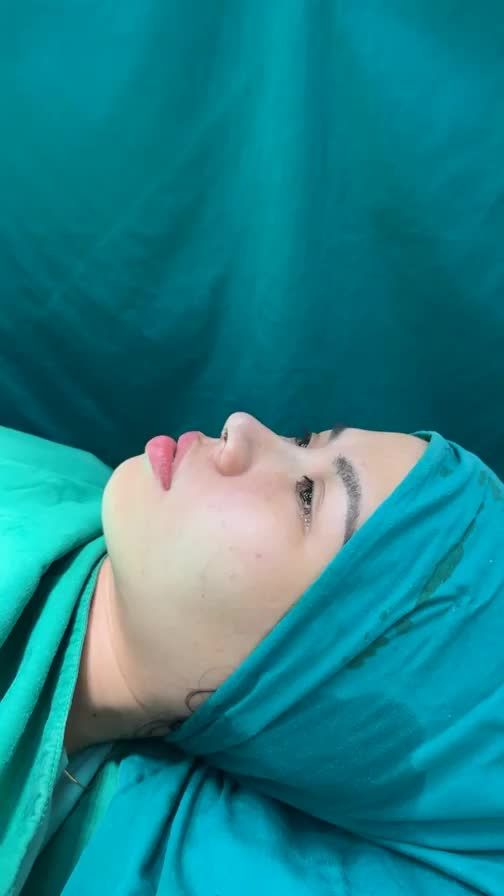 Case mũi cấu trúc vừa hoàn thành
