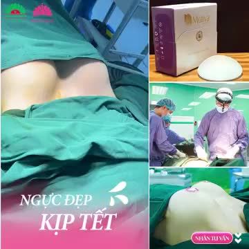 BIẾN HÌNH VÒNG 1 CĂNG ĐẸP CHỈ SAU 60 NÂNG CẤP