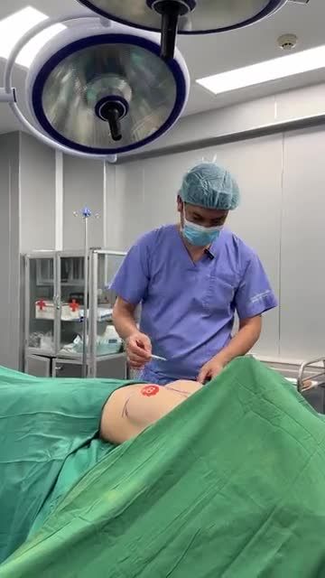BÁC SĨ ĐIỀN PHÂN TÍCH TÌNH TRẠNG NGỰC CỦA CHỊ KHÁCH HÀNG TRƯỚC KHI PHẪU THUẬT