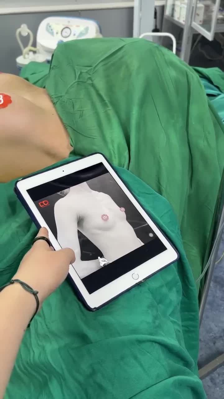ĐÃ CÓ KẾT QUẢ CA NGỰC RỒI CẢ NHÀ ƠI!