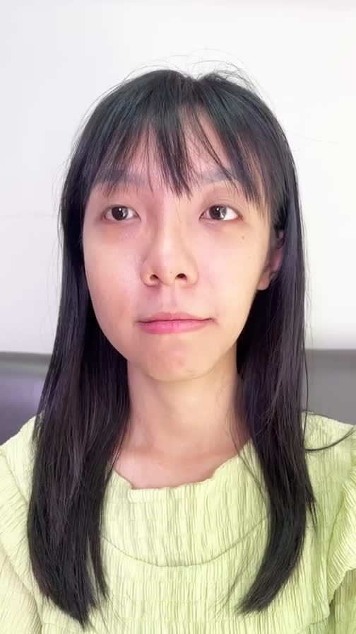 Trò chuyện TRỰC TIẾP cùng nữ khách hàng MẶT LỆCH, TEO CƠ thực hiện dịch vụ GỌT XƯƠNG HÀM + CẤY MỠ MẶT