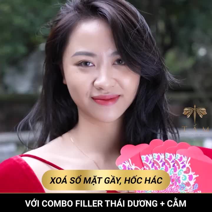 XOÁ SỔ MẶT GẦY, HỐC HÁC VỚI COMBO FILLER THÁI DƯƠNG, CẰM