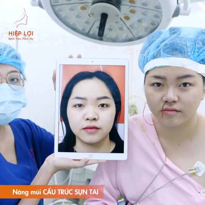 ĐI NÂNG MŨI TẠI HIỆP LỢI, BẠN NHẬN ĐƯỢC NHỮNG GÌ?