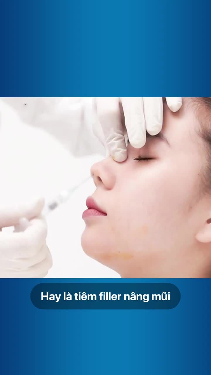 Nên nâng mũi hay tiêm filler cái nào tốt