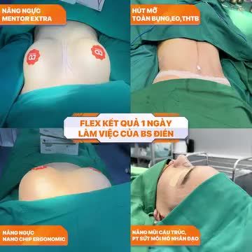 Flex kết quả 1 ngày làm việc của Th.Bs Lê Hữu Điền. Những " bộ loa ""body mới" ra lò.