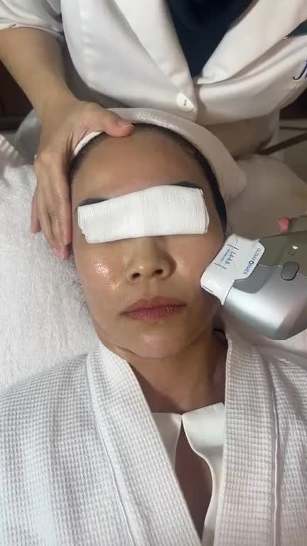 Kết quả sau 2 tháng thực hiện HIFU SMAS NÂNG CƠ kết hợp TIÊM HA CẤP ẨM cho CHỊ GÁI 8X