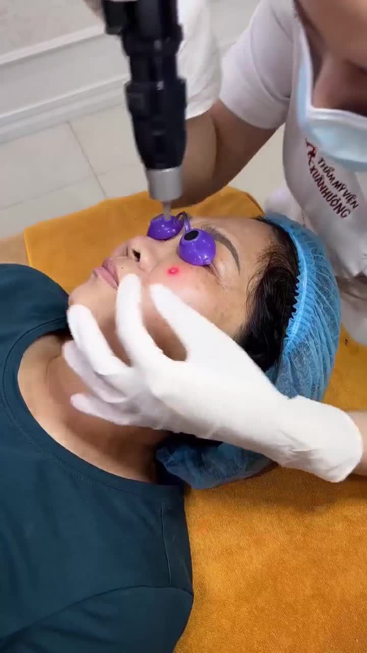 Trị nám buổi 1