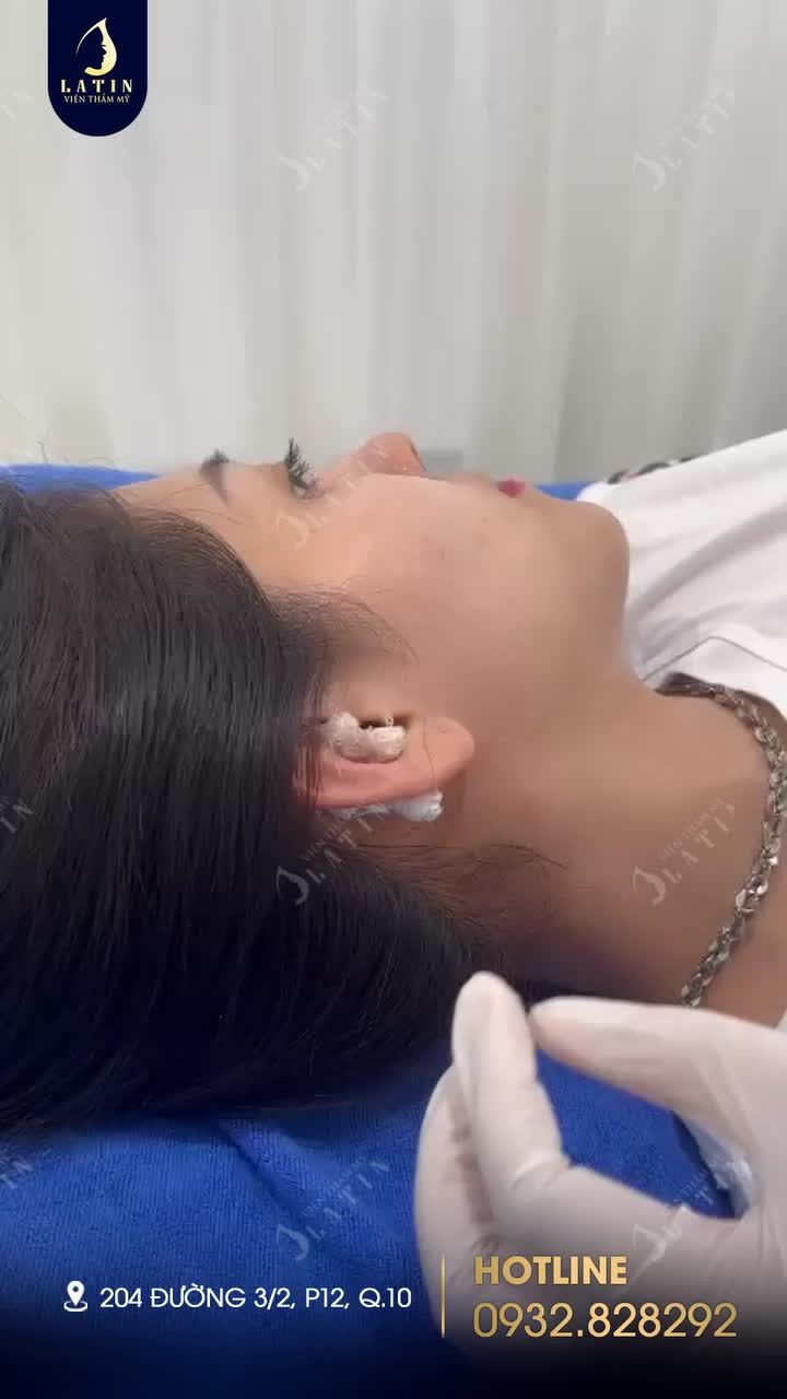 HƯỚNG DẪN CẮT GẠC TAI TẠI NHÀ