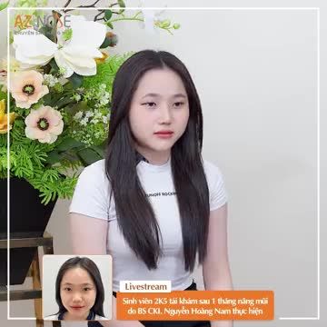 Sinh viên 2K5 chia sẻ cảm nhận sau 1 tháng phẫu thuật