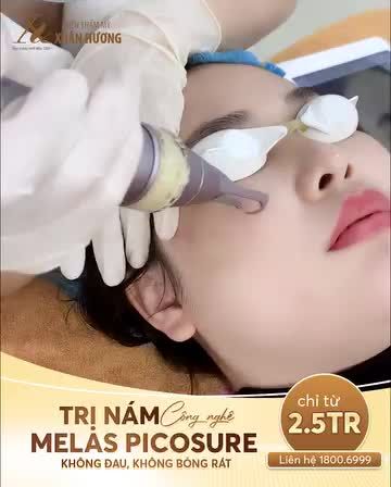 Các nàng bị nám đâu hết rồi, đến Xuân Hương xóa sạch mọi loại nám chỉ từ 2,5 triệu đón Tết thôi
