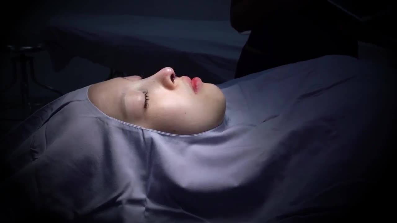 Chỉ với 60 phút, Dr.Hải Lê đã "hô biến" dáng mũi thấp tẹt thành mũi Medi-Form cao bay thượng lưu cho vị khách hàng.