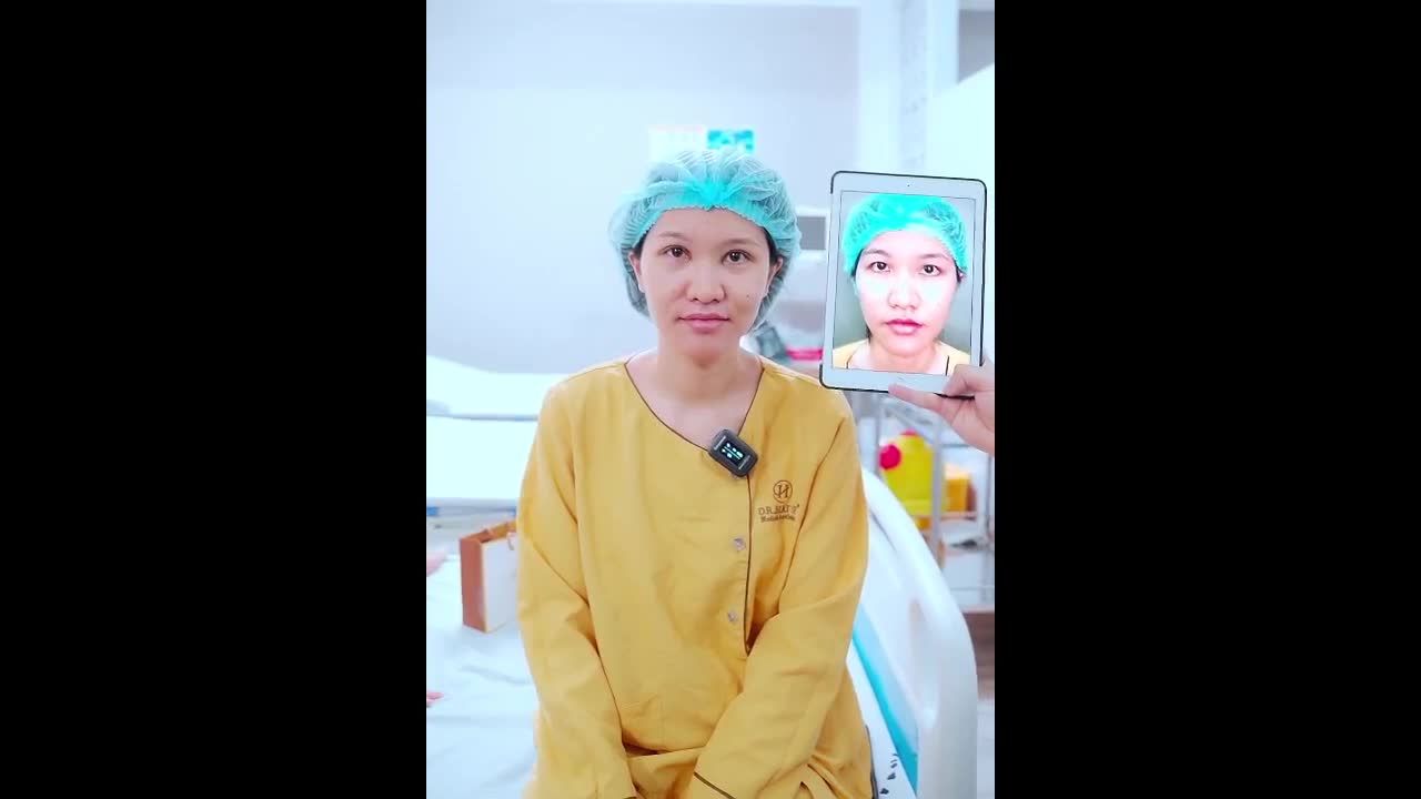 Combo Cắt mí + Mở góc mắt rẻ quạt tại Dr.Hải Lê Sài Gòn đã giúp vị khách hàng trở nên tự tin như thế nào, cùng theo dõi ngay bây giờ nhé!