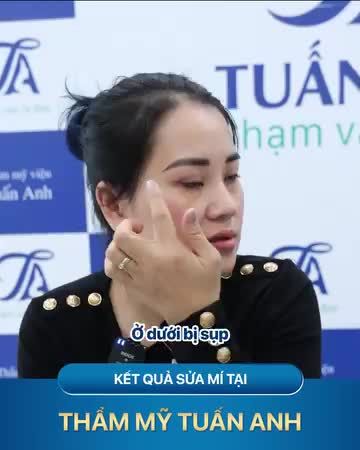 Chị em mà chưa biết sửa mí ở đâu thì tham khảo ngay ở đây nhé!