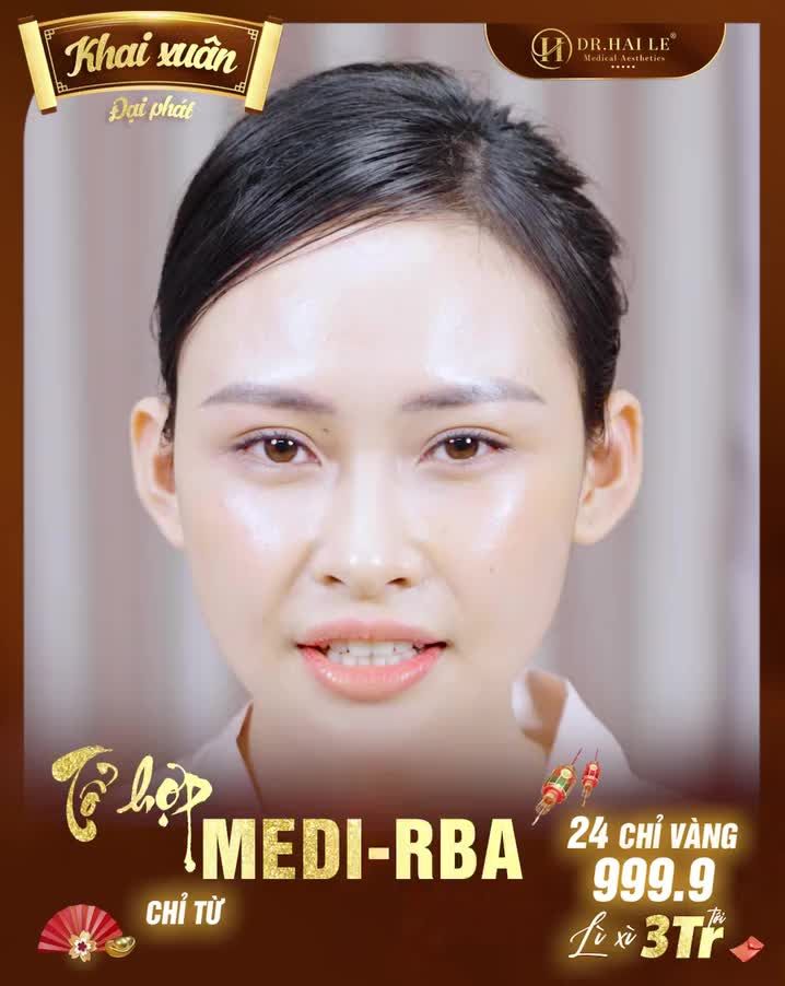 Năm mới đã đến!! Đừng để làn da nhiều khuyết điểm, mụn thâm chi chít, nám, tàn nhang khiến cho bạn mất đi vẻ tự tin vốn có.