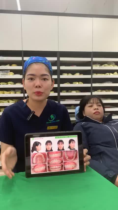 Phân tích chuyên sâu về kế hoạch cho ca niềng răng khắc phục khuyết điểm hô kết hợp xương - răng và quá trình gắn mắc cài cho khách hàng
