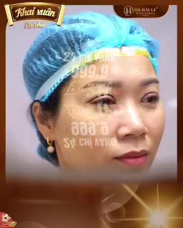 SỬA MÍ DEEP TECH DR.HẢI LÊ - "GIẢI CỨU" MỌI CA MÍ LỖI, HỎNG  HÃY TRAO NIỀM TIN, DR.HẢI LÊ SẼ TRAO CHO BẠN SỰ TỰ TIN