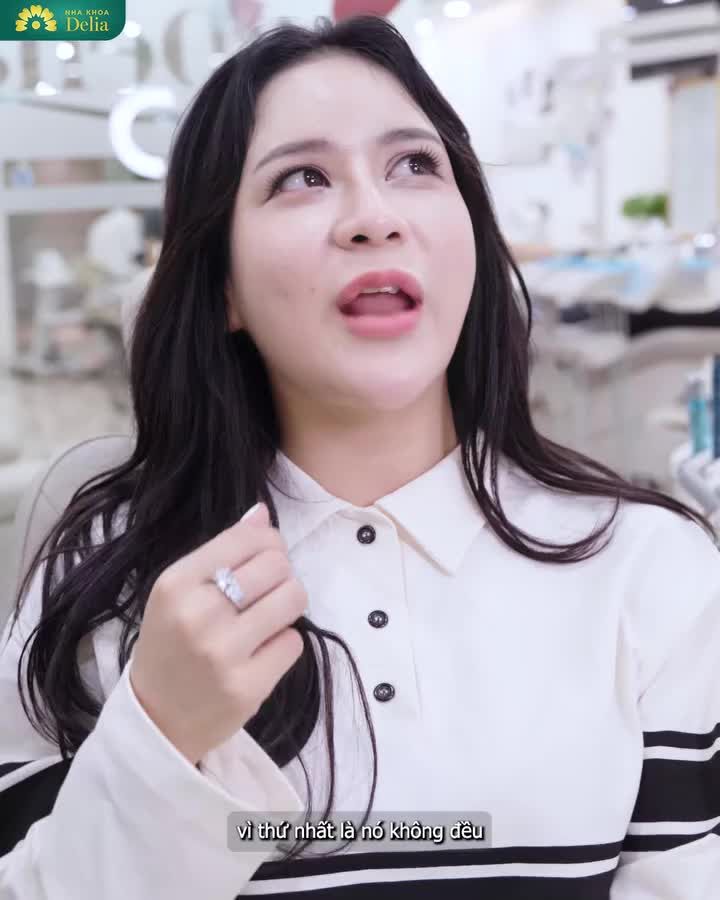 Răng khấp khểnh, tình trạng mòn cổ chân răng, có nguy cơ hỏng tủy răng  Quyết định bọc 20 răng sứ Emax và cái kết...