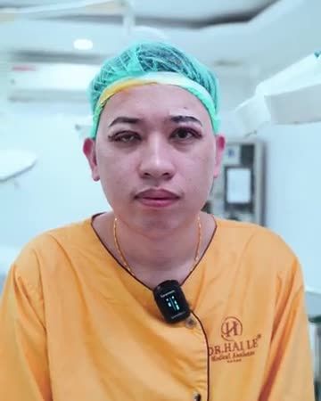 Mí mắt bệnh lý sụp bẩm sinh độ nặng được Dr.Hải Lê chỉnh hình thành công như thế nào? Theo dõi ngay