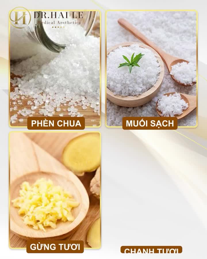 Đánh bay mùi hôi nách với công nghệ miraDry