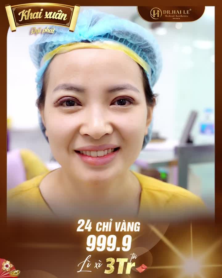 Bao nhiêu năm sống chung với đôi mắt sụp mí bẩm sinh, đã đến lúc bạn phải thay đổi rồi