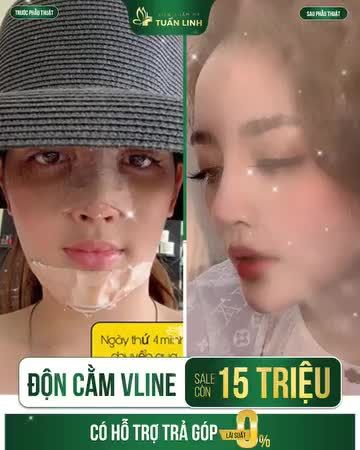 ĐỘN CẰM VLINE - ĐẸP THỜI THƯỢNG - GIÁ CHỈ TỪ 15 TRIỆU