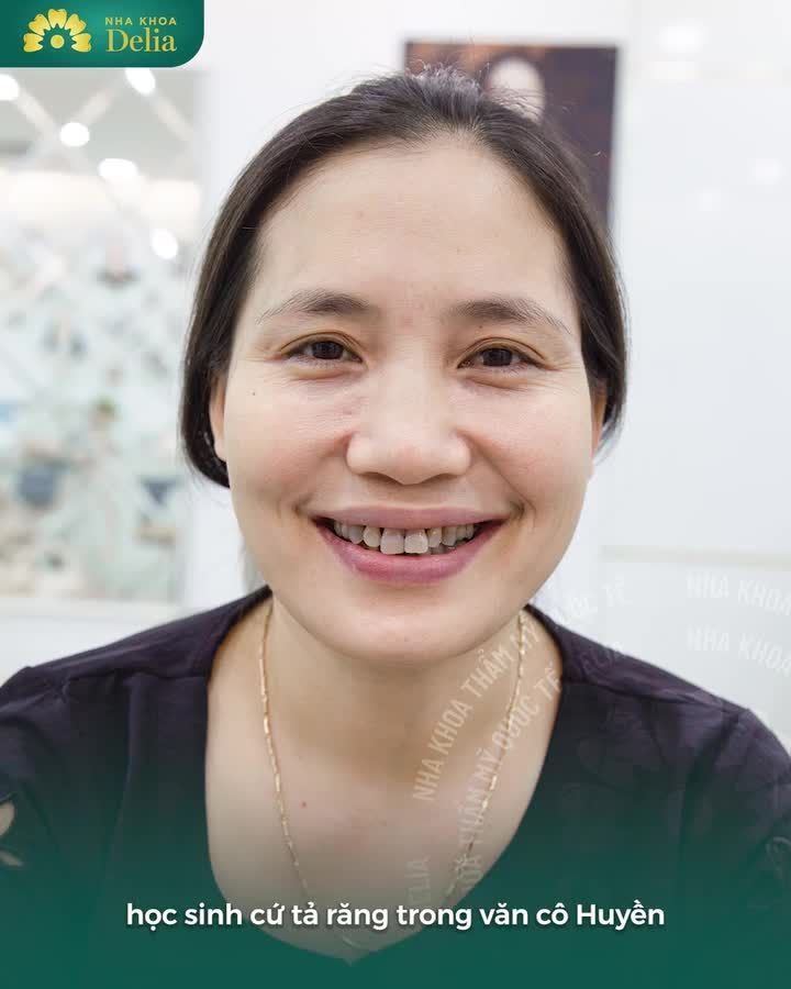 Biến hình từ “hàm răng đen” trong bài văn của học trò đến hình ảnh cô giáo tự tin với nụ cười rạng rỡ!