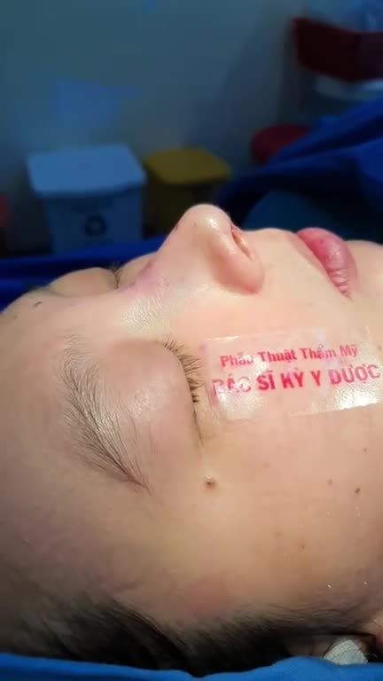 Dáng mũi thấp đều, gần như không có sống mũi làm bạn cảm thấy tự ti. Từ đó, bạn muốn thay đổi bản thân để trở thành một phiên bản xinh đẹp hơn cùng chiếc mũi cao thanh tự nhiên.